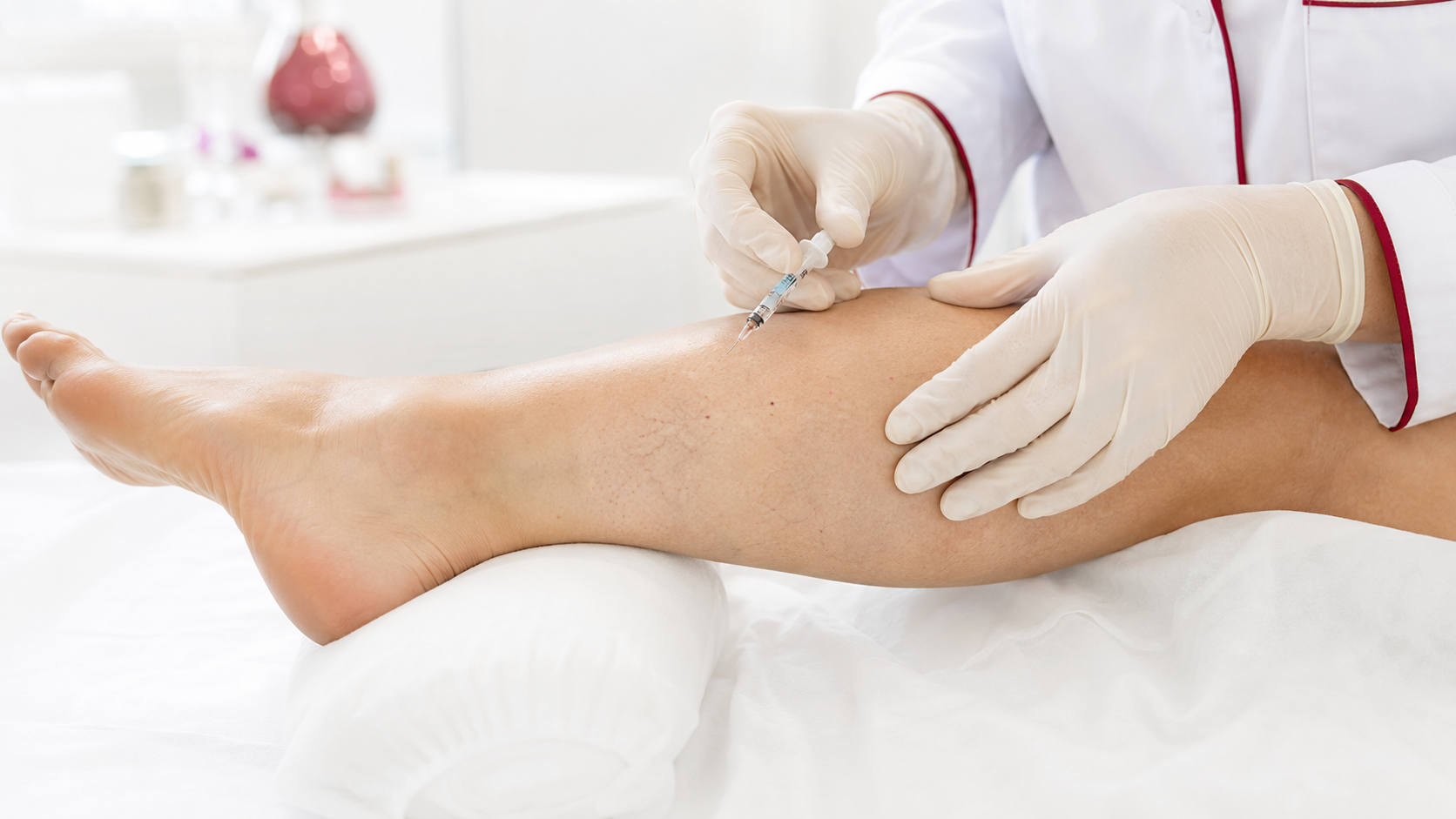 Mesoterapia-esterno-coscia