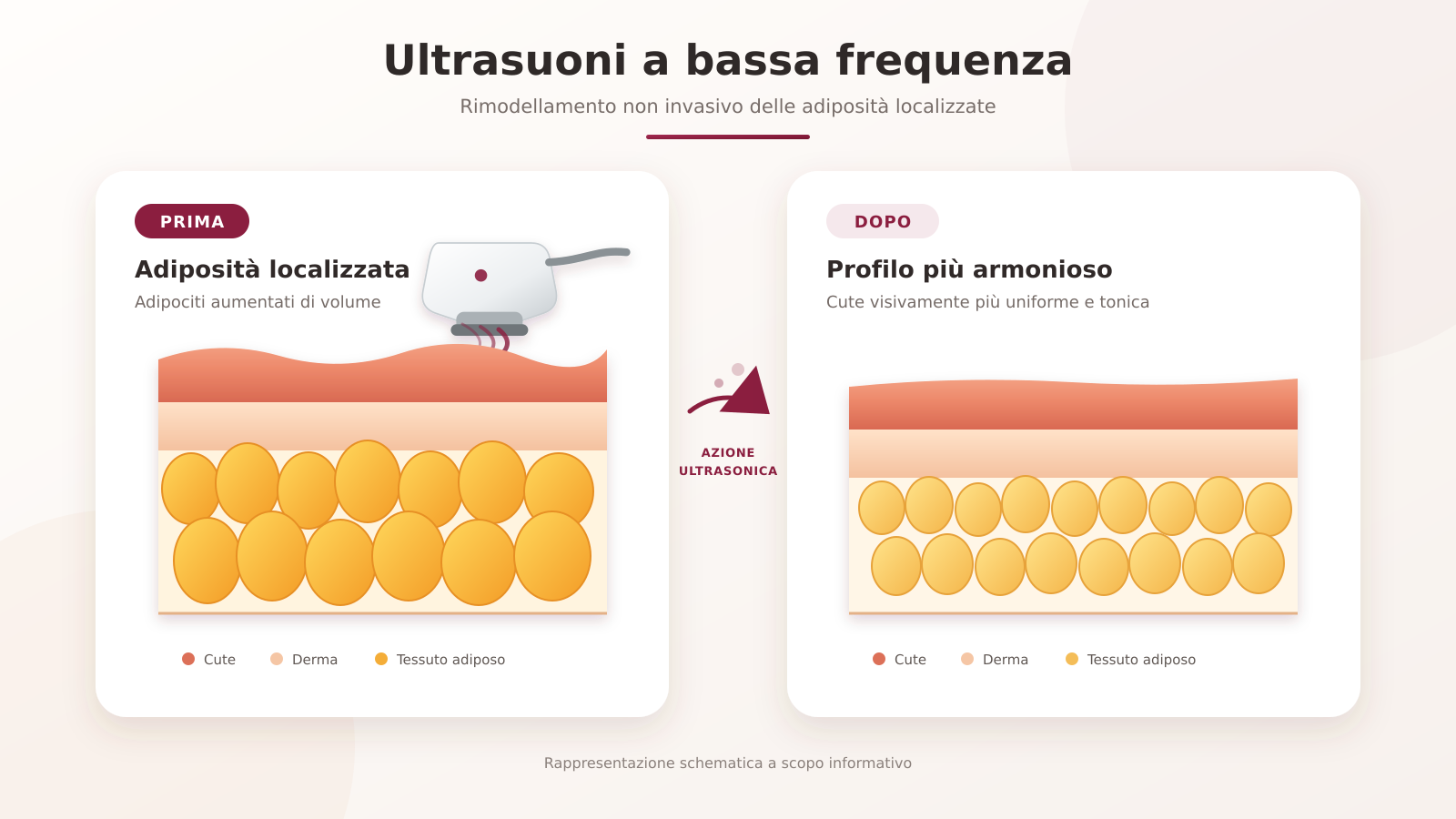 Epilazione-gambe-fili-trazione-corpo-cavitazione-addome Epilazione-fili-trazione-cavitazione